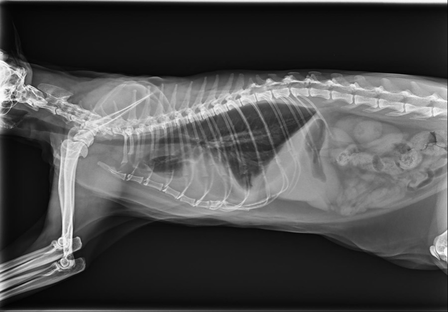 Рентген высокого разрешения помогает в постановке диагноза — гнойный плеврит