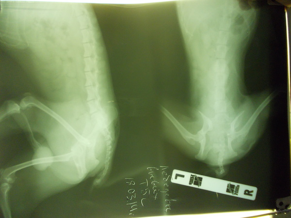 Вывих тазобедренного сустава – частая патология при автотравмах после операции